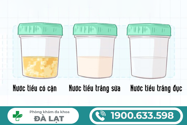 Hình ảnh minh họa